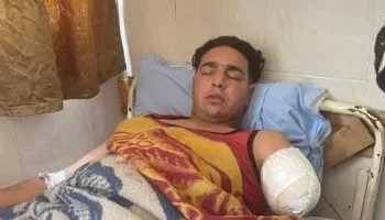 بتر ذراع عامل سيرك بعد هجوم أسد مفترس خلال عرض بطنطا