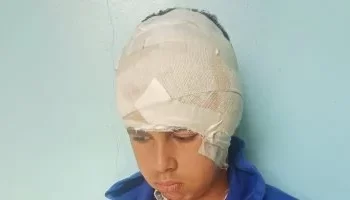 تفاصيل مأساوية.. طالب يتعرض لاعتداء عنيف بسلاح أبيض من زميلين في أوسيم
