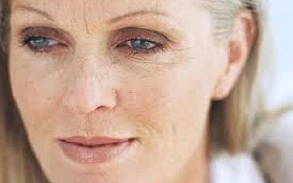 أنواع تجاعيد البشرة مع التقدم في العمر… تعرفي عليها