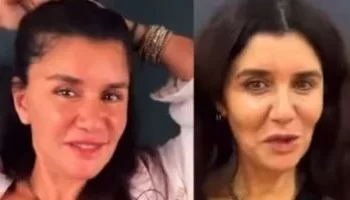 غادة عادل تخضع لعملية شد وجه وتُبدي سعادتها بالنتيجة