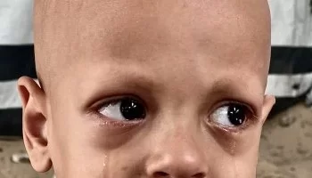 وفاة الطفل الفلسطيني “عبد الله أبو زرقة” صاحب صرخة “أنا جعان”