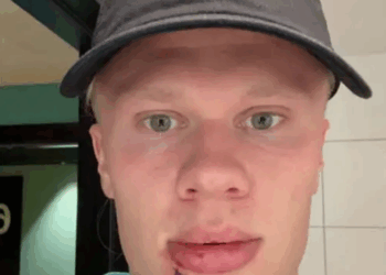 إصابة قوية لـ هالاند بسبب حادث غريب قبل مواجهة مولدوفا