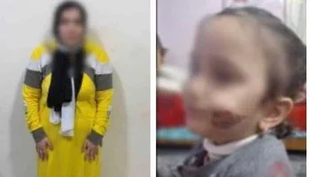 الأمن يكشف ملابسات فيديو طفلة كفر الشيخ: أم تحرق وجه ابنتها بآلة ساخنة عقابًا لزيارتها أهل طليقها