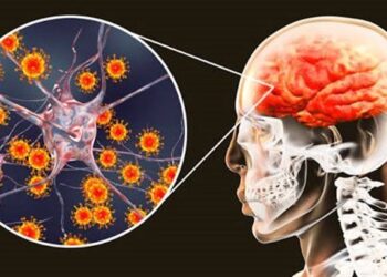 دراسة علمية: 259 ألف وفاة سنويا بسبب التهاب السحايا رغم تراجع معدلات الإصابة عالميا