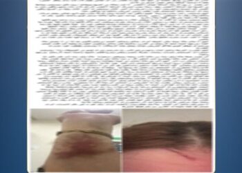 الداخلية تكشف تفاصيل واقعة التعدي على ممرضتين داخل مستشفى ببورسعيد